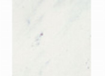 To sell aristone(picture)